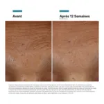 Skinceuticals HA Intensifier Multi-Glycan Sérum