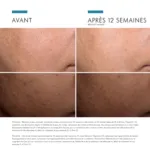 SkinCeuticals Discoloration Defense Serum