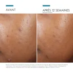 Skinceuticals Phyto A+ Brightening Treatment