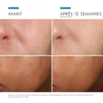 SkinCeuticals Prevent Phloretin CF sérum antioxydant