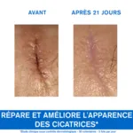 Uriage Bariéderm cica SOS crème réparatrice