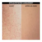 Alvadiem Keratolia+ Fluide corps anti-rugosités