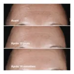 Clinique Smart clinical repair Sérum correcteur anti rides