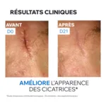 Uriage Bariéderm Cica+ Crème réparatrice