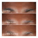 Clinique Smart clinical repair Sérum correcteur anti rides