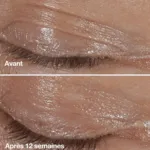 Clinique Smart Clinical Crème yeux correction rides