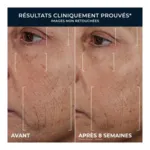 Roc Retinol Correxion Lissant rides Triple sérum