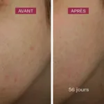 Biarritz Sérum anti taches