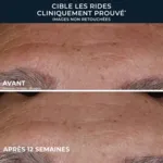 Roc Retinol Correxion Sérum correction rides