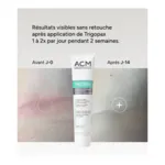 Trigopax crème