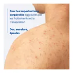 Ducray Keracnyl Spray corps asséchant anti boutons