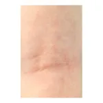 Dexeryl Crème sécheresse cutanée
