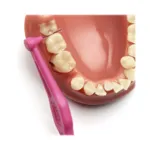 TePe Angle brossette interdentaire