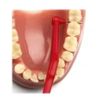 TePe Angle brossette interdentaire