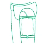 B Braun Urimed Fix porte-poche ambulatoire par 2