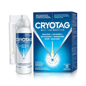 Traitement acrochordons Cryotag Skin Tag Remover